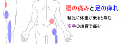 腰の痛みと足のしびれ | 手足・腰の痛み、しびれ