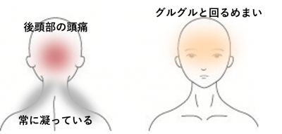 グルグル回るめまい | 首から上の症状