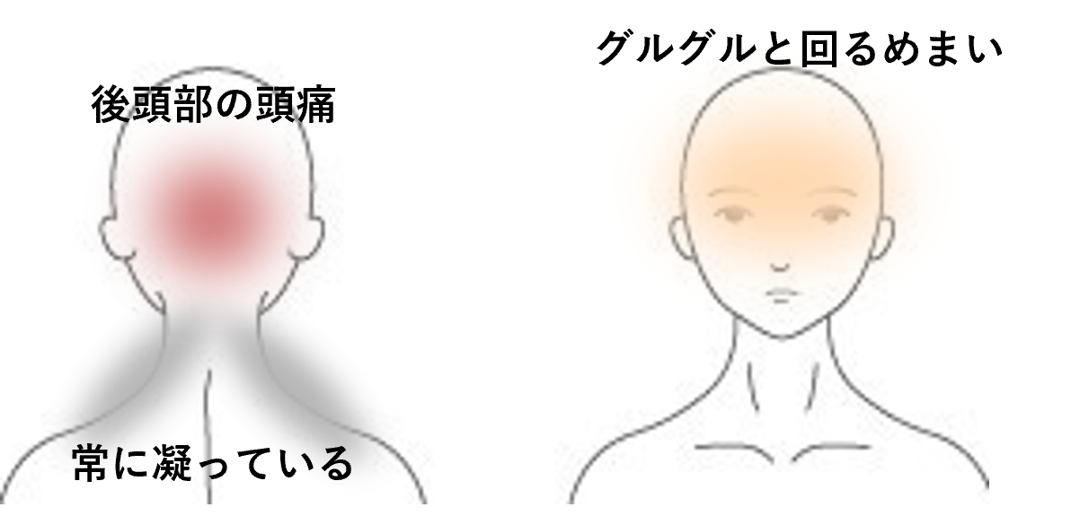 グルグル回るめまい | 首から上の症状