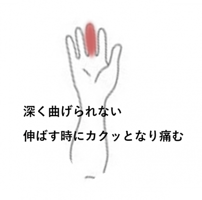 途中で引っかかり深く曲がらない | 手足・腰の痛み、しびれ