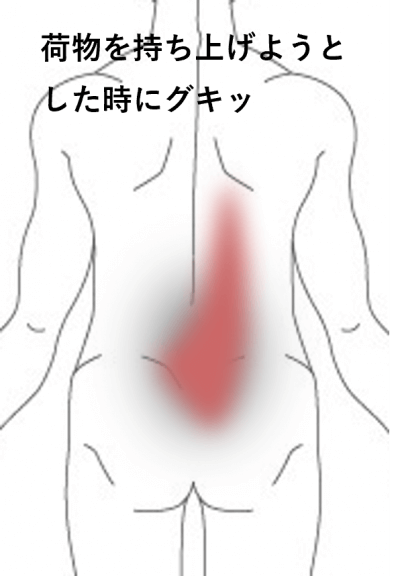 荷物を持ち上げようとした時にグキッとなった | 手足・腰の痛み、しびれ