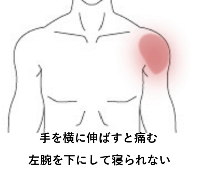 手を横に伸ばすと痛む・左腕を下にして寝られない | 手足・腰の痛み、しびれ