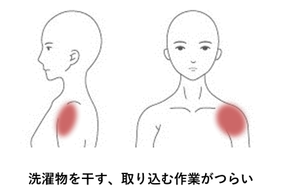 洗濯物を干す・取り込む作業がつらい | 手足・腰の痛み、しびれ