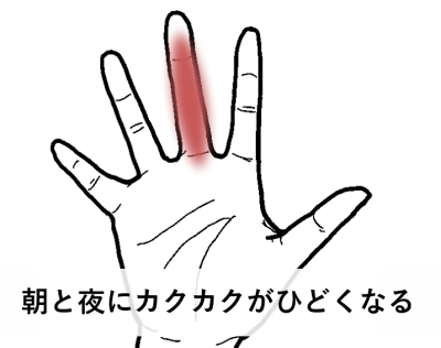 朝と夜にカクカクがひどくなる | 手足・腰の痛み、しびれ