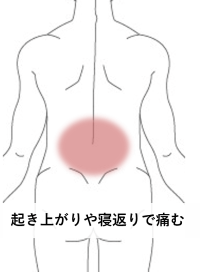 起き上がりや寝返りで痛む | 手足・腰の痛み、しびれ