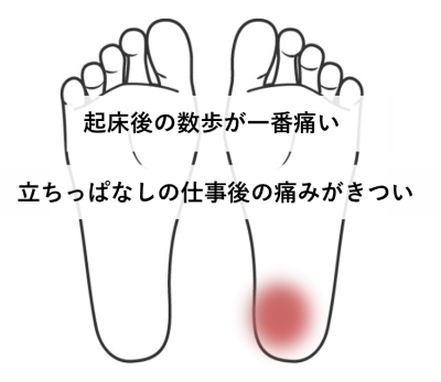 新し靴 人気 踵が痛い