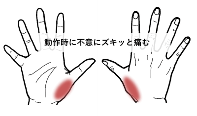 動作時に不意にズキッと痛む | 手足・腰の痛み、しびれ